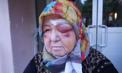 Edirne'de Başıboş Köpeklerin Saldırısına Uğrayan Yaşlı Kadın Ölümden Döndü