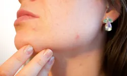 Sağlıklı ve Canlı Bir Cilt İçin İpuçları! Yaz Aylarında Nelere Dikkat Edilmeli?