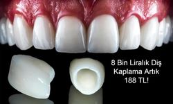 8 Bin Liralık Diş Kaplama Artık 188 TL! Yeni Uygulama Sosyal Medyada Gündem Oldu”