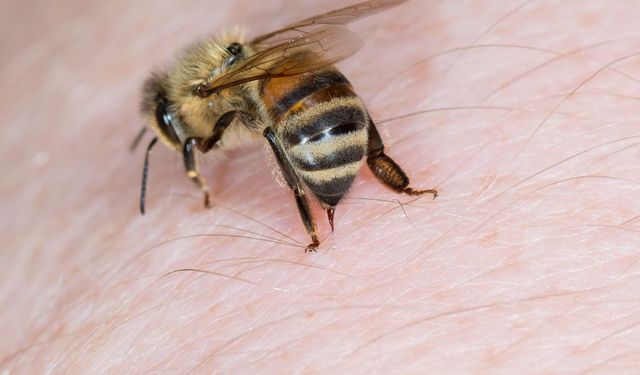 Arı Sokmasına Karşı Alınacak Önlemler: Ağrı ve Şişliği Azaltan Yöntemler