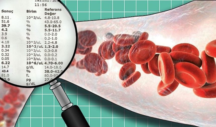 Hemogram Hgb Düşüklüğü Neden Olur, Hangi Belirtilerle Ortaya Çıkar? Hemoglobin Eksikliği İçin Hangi Besinleri Tüketmelisiniz?