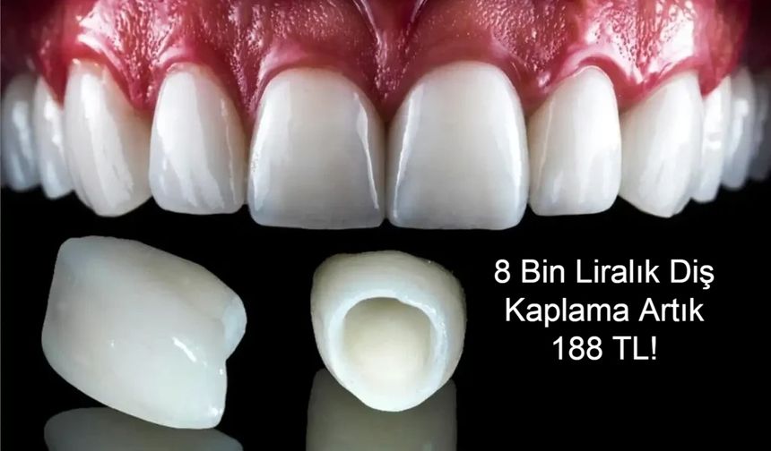 8 Bin Liralık Diş Kaplama Artık 188 TL! Yeni Uygulama Sosyal Medyada Gündem Oldu”