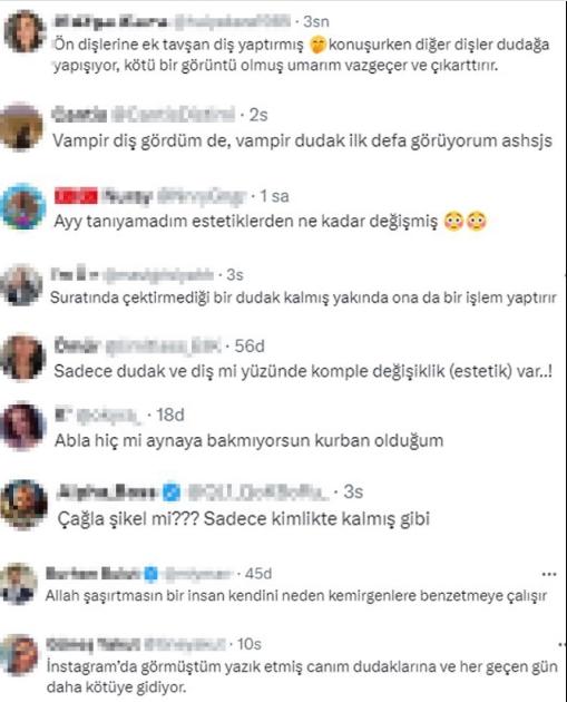 Cagla Sikel Estetik Mi Yaptirdi Cagla Sikel 17221349 7814 M