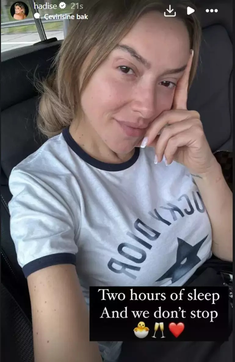 Hadise Filtre Ve Photoshop Uygulamadı